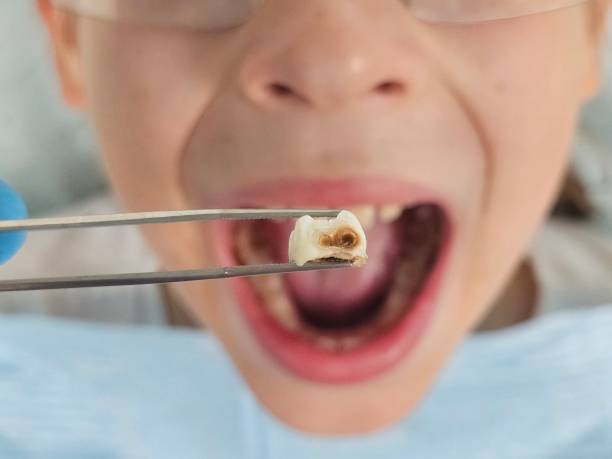 Best Urgent Dental Care for Toothaches in Powell, AL